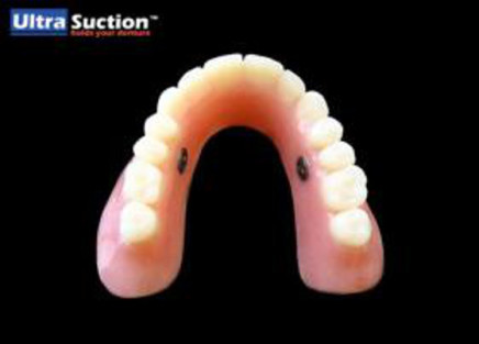 Ultra Suction Dentures